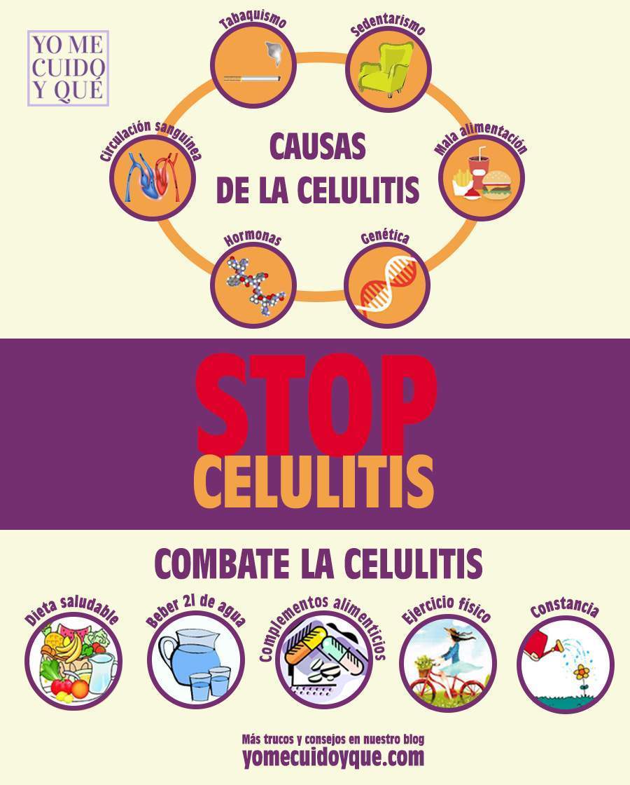 Combate la celulitis con estos trucos